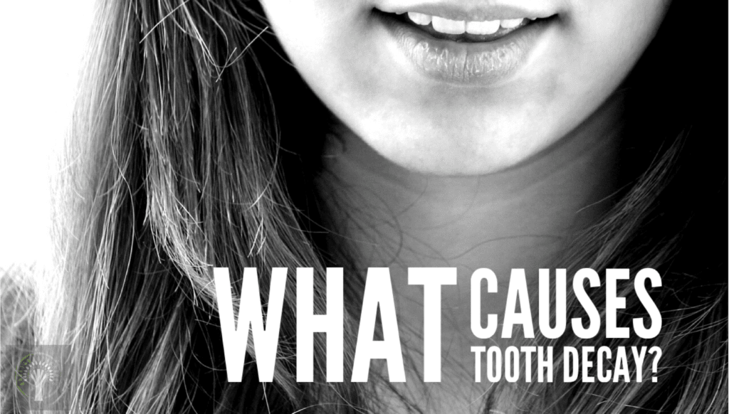 what-causes-tooth-decay-eccleshill-dental