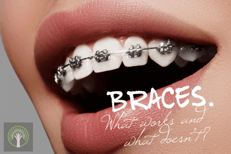 Braces. What Works and What Doesn’t? - Eccleshill Dental